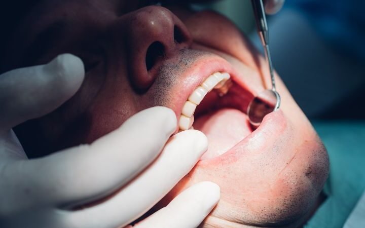Dental professionals highlight oral health risks associated with marijuana use