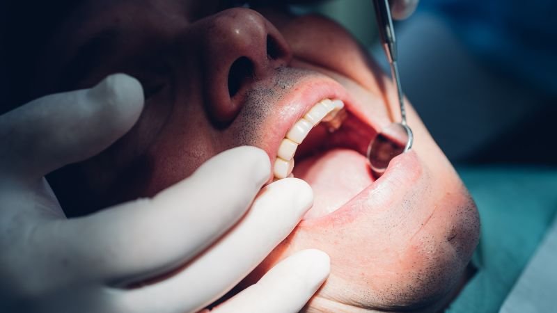 Dental professionals highlight oral health risks associated with marijuana use