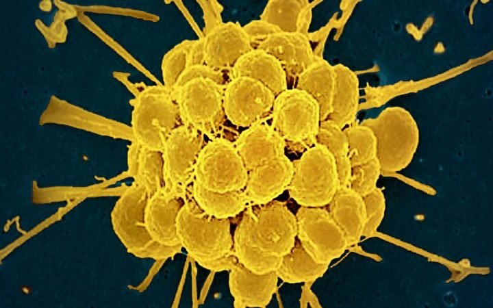 FDA approves first new antibiotics for gonorrhea in decades amid rising drug resistance
