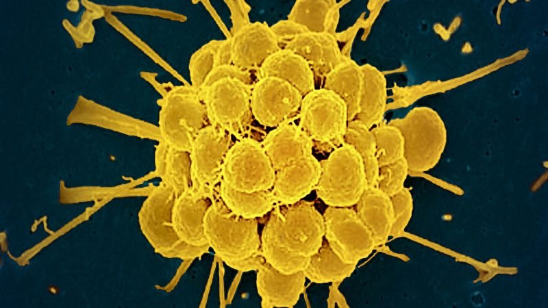 FDA approves first new antibiotics for gonorrhea in decades amid rising drug resistance
