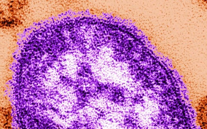 Measles outbreak in South Carolina linked to declining vaccination rates and community hesitancy