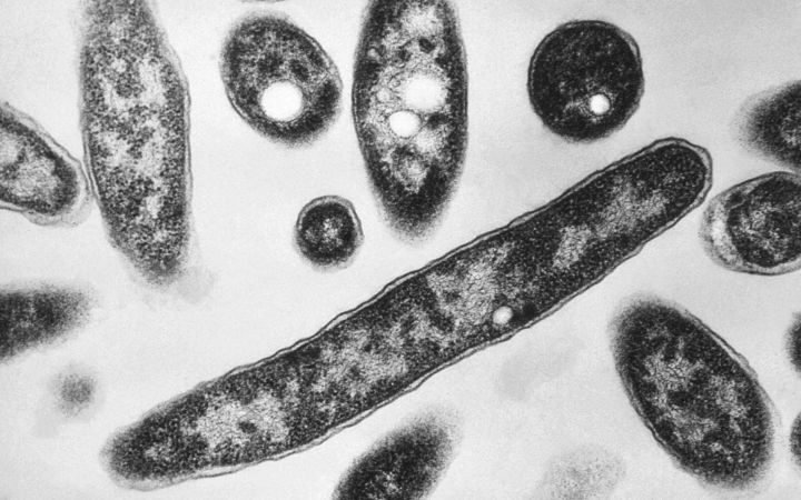 New York City declares end of Legionnaires' disease outbreak after seven deaths and 84 hospitalizations